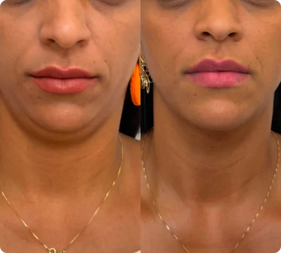 unsplash-kfcdflbu6za-16-66fae7a2e58ea