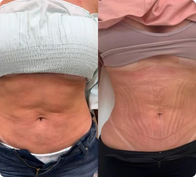 unsplash-kfcdflbu6za-18-66fae7a4450db