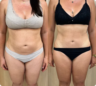 unsplash-kfcdflbu6za-20-66fae7a57e98e