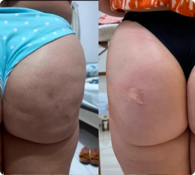 unsplash-kfcdflbu6za-21-66fae7a5e10d1