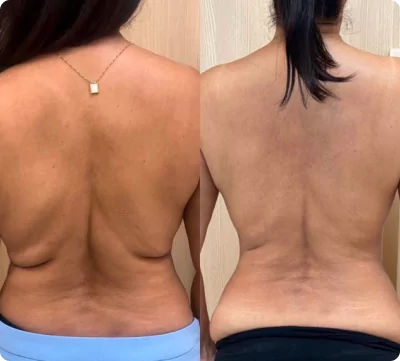 unsplash-kfcdflbu6za-22-66fae7a6a339c