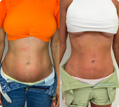 unsplash-kfcdflbu6za-5-66fae7af0e0e6