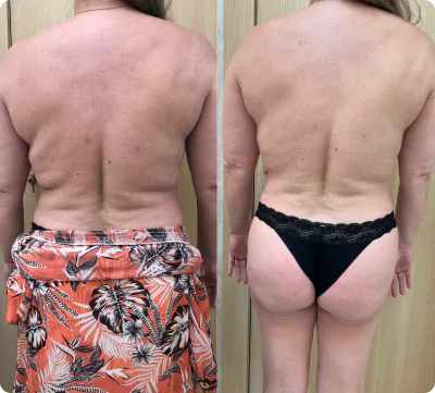 unsplash-kfcdflbu6za-6-66fae7b01cda8