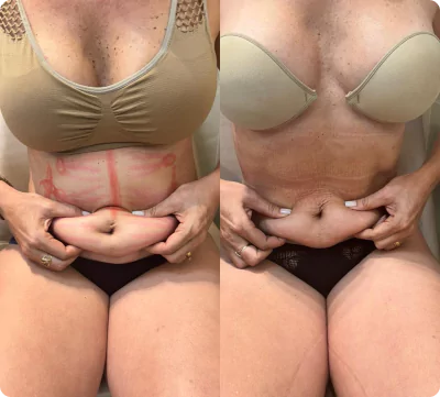 unsplash-kfcdflbu6za-9-66fae7b1825f8